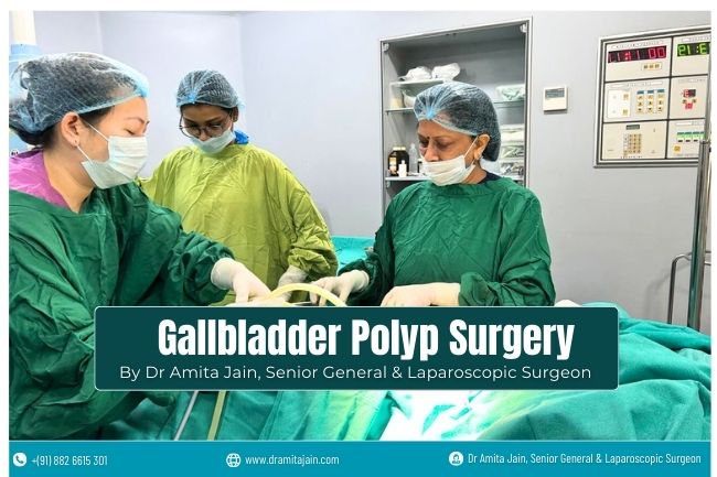 Dr Amita Jain Gallbladder Polyp Surgeon in Delhi